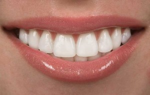 veneers from Eagle Dental Practice Liphook